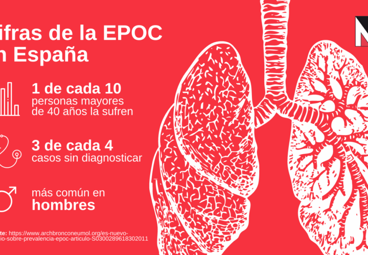 La EPOC es una epidemia prevenible y tratable que representa la tercera causa de muerte en España